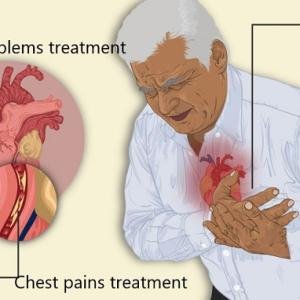 Cardiac Arrest Treatment Medicine in Accra, Ghana