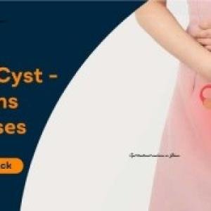 Ovarian Cyst Treatment Supplements and Natural Antibiotics in Accra, Ghana