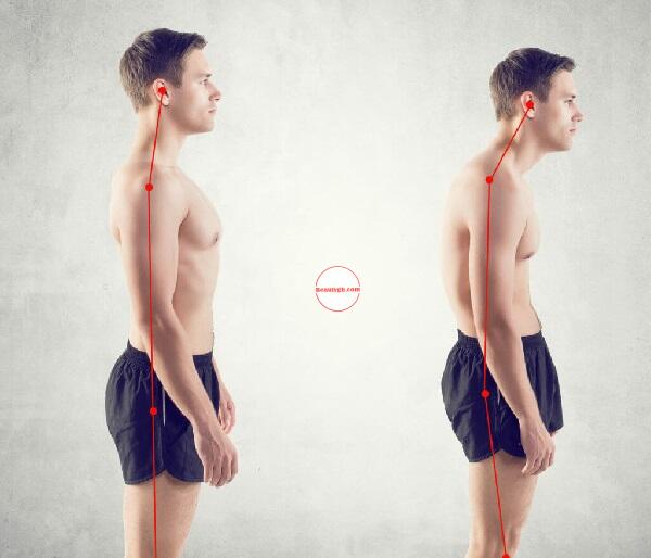 How to Improve Your Posture for a Pain-Free Life