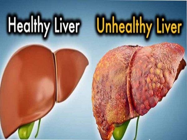 Main Functions of the Liver and Natural Remedies For Liver Detoxification