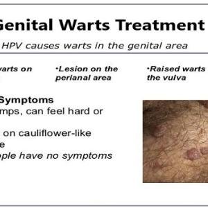 Genital Warts Treatment Medicine and Removal Cream in Accra, Ghana