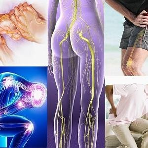 Nerve Pain Treatment Medicine in Accra, Ghana