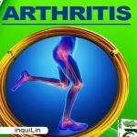 Arthritis Treatment Medicine in Accra, Ghana